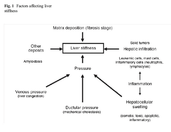 Fibroscan Score Chart