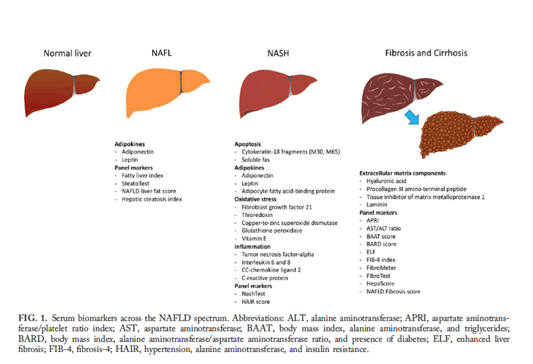Serum biomarkers for nonalcoholic fatty liver disease: Are we there yet ...